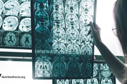 A Persistent Pesticide Is Linked to Alzheimer’s Risk