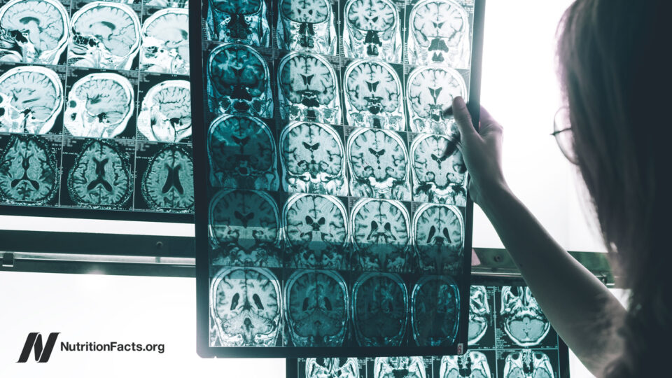 A Persistent Pesticide Is Linked to Alzheimer’s Risk