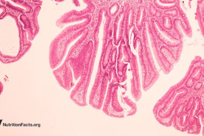 Could Bovine Leukemia Virus be a Cause of Breast Cancer?