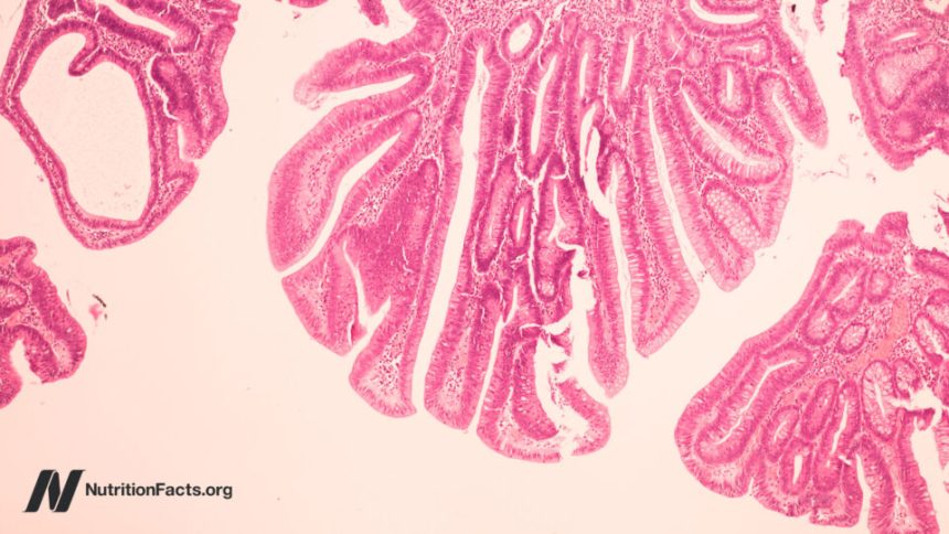 Could Bovine Leukemia Virus be a Cause of Breast Cancer?