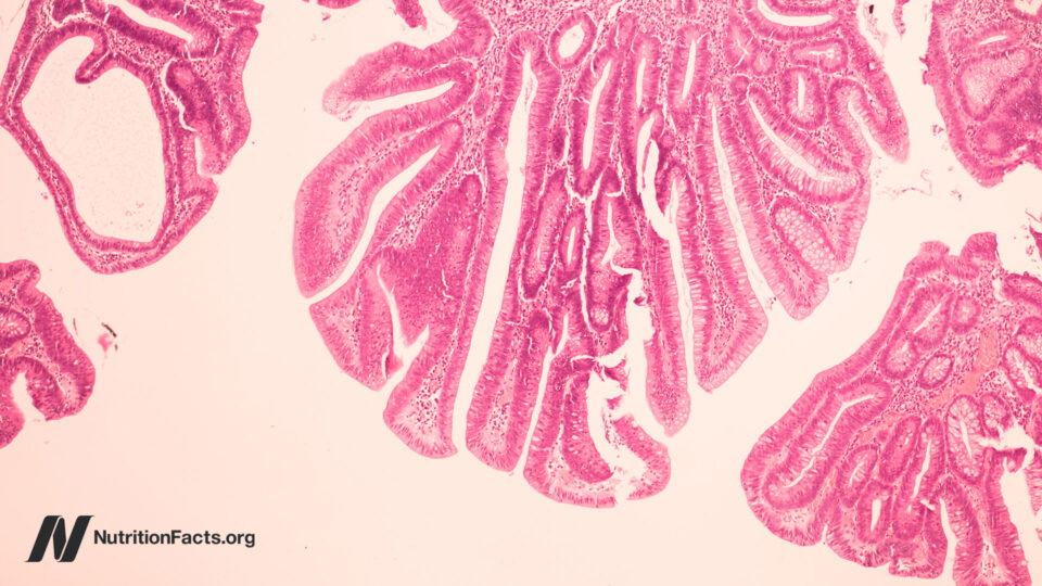 Could Bovine Leukemia Virus be a Cause of Breast Cancer?