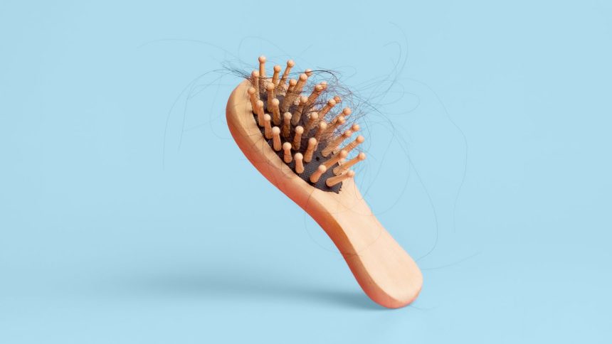 Who Is More Likely to Lose Their Hair — Men or Women?