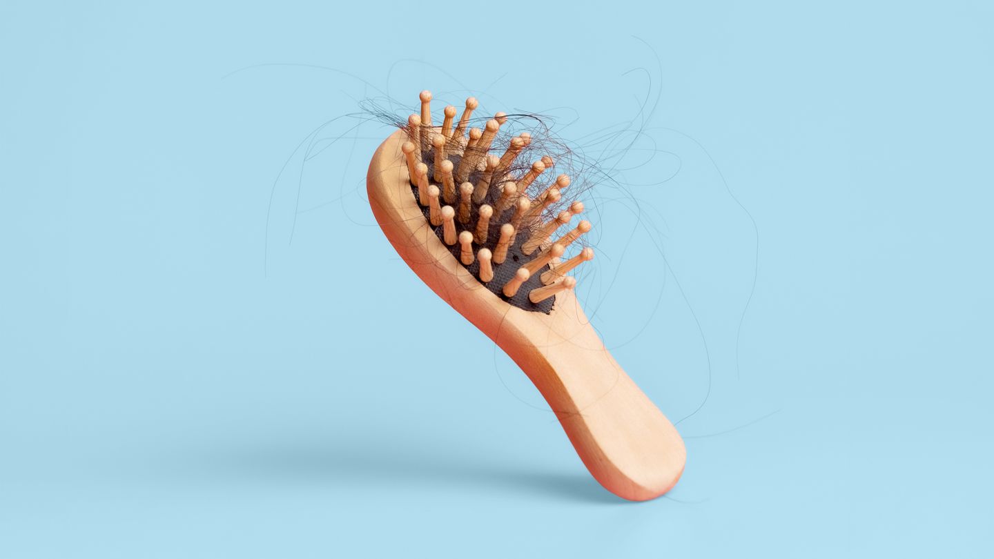 Who Is More Likely to Lose Their Hair — Men or Women?