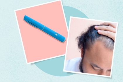 Do GLP-1s Cause Hair Loss? What to Know and What You Can Do