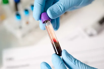 What Are Triglycerides?
