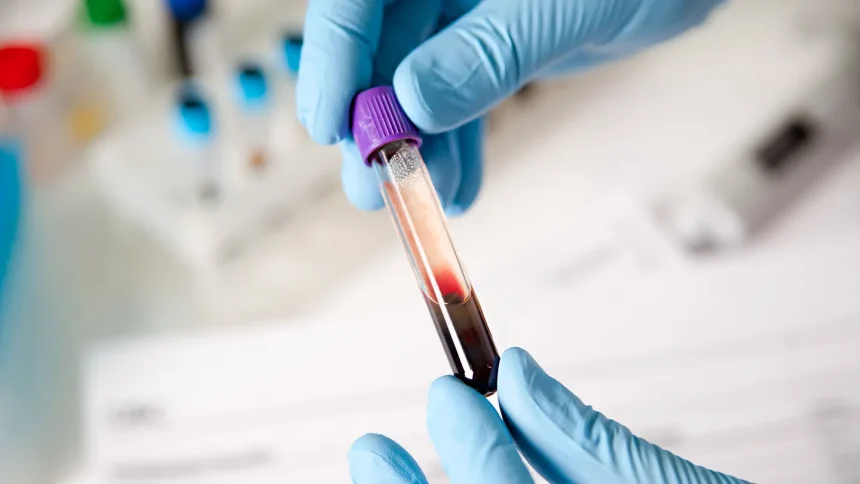 What Are Triglycerides?