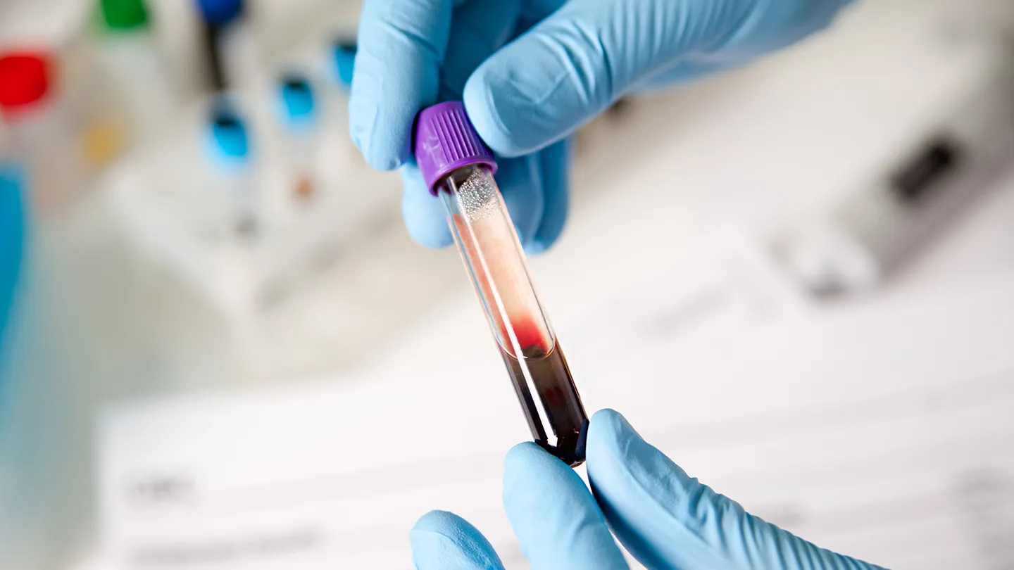 What Are Triglycerides?
