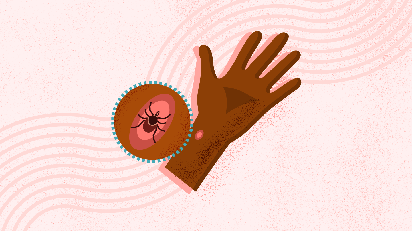 What Is Lyme Disease?