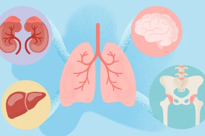 How Lung Cancer Spreads: Tracking Metastasis Paths