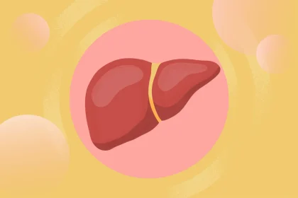 Psoriasis and Your Risk of Metabolic Dysfunction–Associated Steatotic Liver Disease