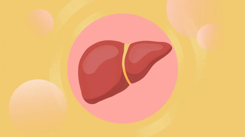 Psoriasis and Your Risk of Metabolic Dysfunction–Associated Steatotic Liver Disease