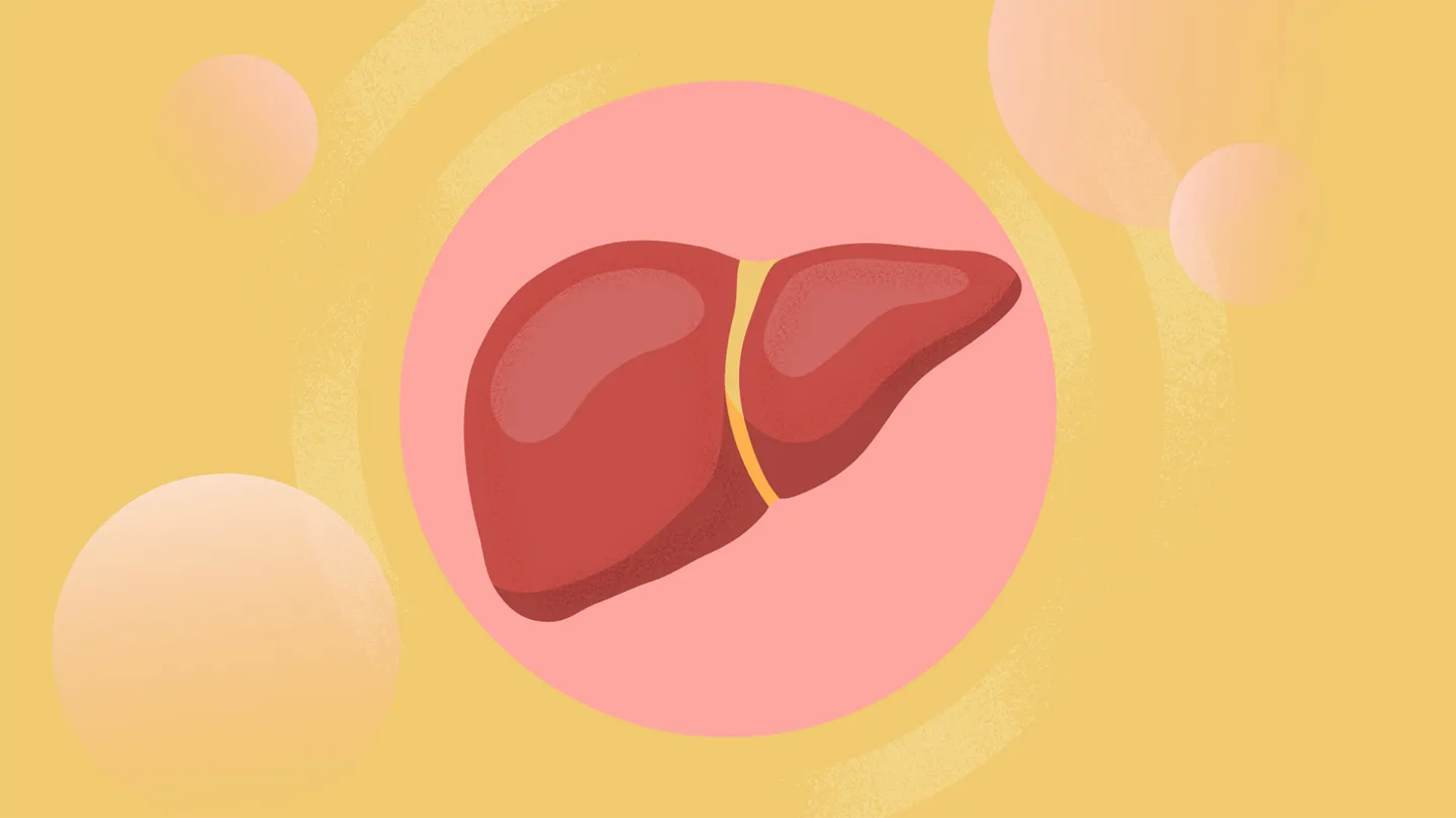Psoriasis and Your Risk of Metabolic Dysfunction–Associated Steatotic Liver Disease