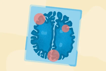 This Hormonal Shift Might Explain Why Your Mood Can Take a Dive the Week Before Your Period Starts