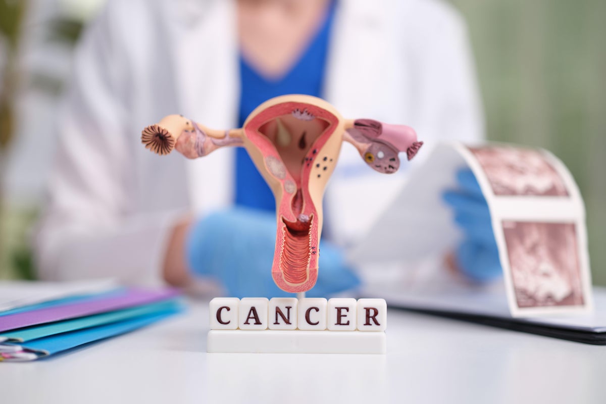 Seven key facts every woman should know about womb cancer