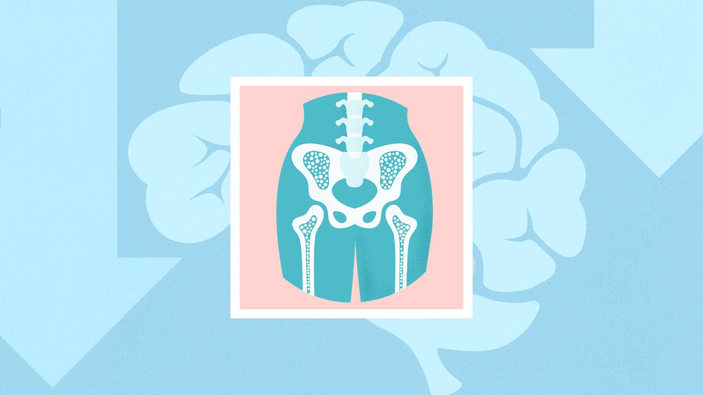 Bone Loss Linked to Brain Issues in New Study