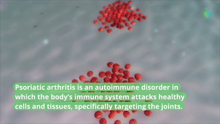 12 Medical Tests for Psoriatic Arthritis, Explained