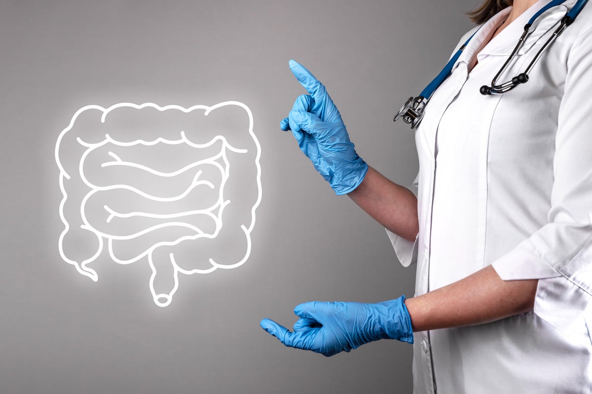 Five silent bowel cancer signs that experts warn you should not ignore
