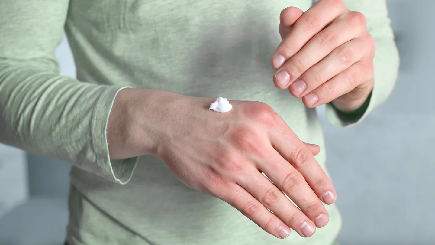 9 Ways to Prevent Atopic Dermatitis (Eczema) Flares in Cold Weather